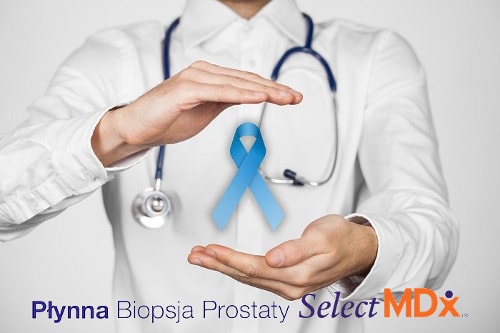 Płynna biopsja prostaty SelectMDx